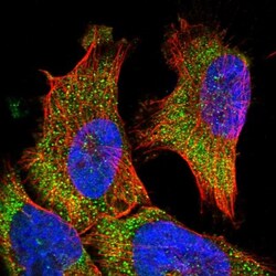 VPS37A Antibody, Novus Biologicals 0.1mL; Unlabeled:Antibodies, Polyclonal